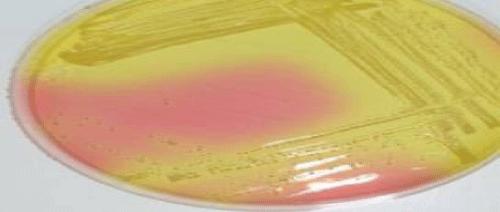 Foodborne Risks Associated with Multidrug-Resistant Escherichia coli and Staphylococcus aureus Isolated from Milk