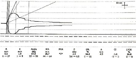 Conceptual Errors in the Diagnosis, Prevention, and Treatment of Disseminated Intravascular Coagulation: An Analysis of Leading Guidelines and Key Publications