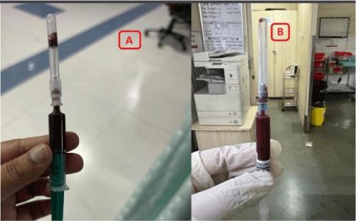 Management of Methemoglobinemia due to Terpene-lactoid Poisoning: A Case Report